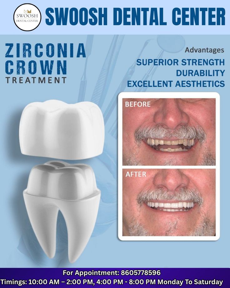 Zirconia Crown