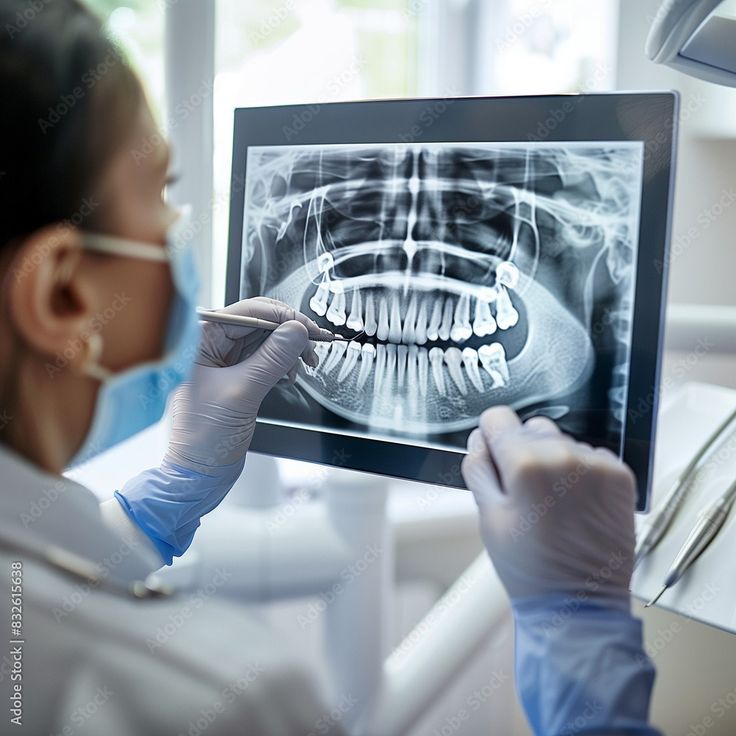RVG (X-Ray)